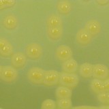 黄色ブドウ球菌　コロニー拡大写真