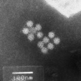 ノロウイルス　電子顕微鏡写真