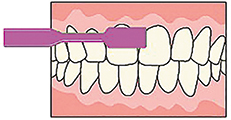 歯周病予防の歯茎磨きのイメージ画像