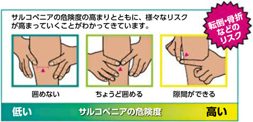 サルコペニアの危険度　イメージ図