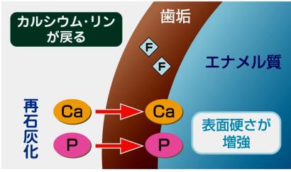 再石灰化の図