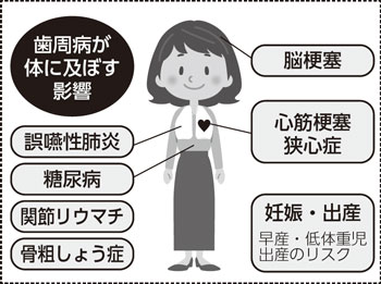 歯周病が体に及ぼす影響