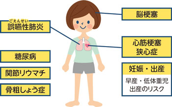歯周病が全身に及ぼす影響